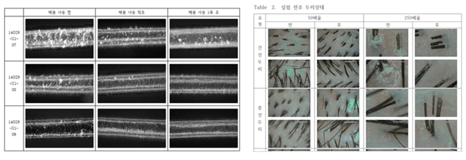 Verbesserung der Kopfhaut durch akustische Vibration - Therapiegold